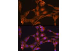 Immunofluorescence analysis of NIH-3T3 cells using CLOCK Rabbit mAb (ABIN7266414) at dilution of 1:100 (40x lens). (CLOCK 抗体)