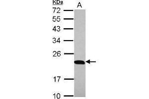 Western Blotting (WB) image for anti-Prostaglandin E Synthase 3 (Cytosolic) (PTGES3) antibody (ABIN2856401)