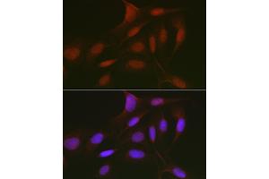 Immunofluorescence analysis of U2OS cells using RBL2 Rabbit pAb (ABIN7269943) at dilution of 1:50 (40x lens). (p130 抗体  (AA 100-200))