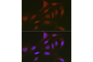 Immunofluorescence analysis of U2OS cells using RBL2 Rabbit pAb (ABIN7269943) at dilution of 1:50 (40x lens).
