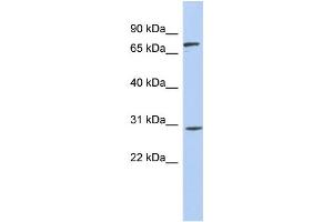 WB Suggested Anti-ZNF131 Antibody Titration:  0. (ZNF131 抗体  (Middle Region))