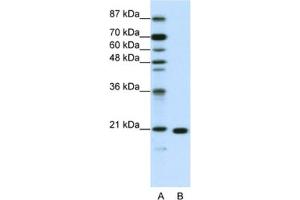 Western Blotting (WB) image for anti-Ribosomal Protein L9 (RPL9) antibody (ABIN2462050) (RPL9 抗体)