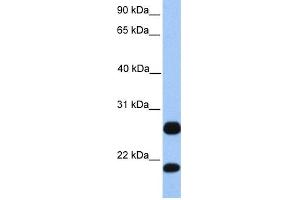 WB Suggested Anti-C1orf63 Antibody Titration:  0. (C1orf63 抗体  (C-Term))