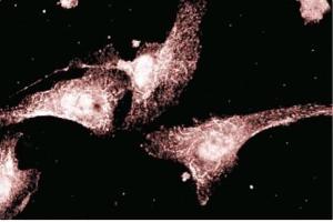 Immunofluorescent staining of endothelial cells. (AKAP5 抗体  (AA 180-427))