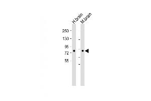 All lanes :DCKL1 Antibody (C-term) at 1:2000 dilution Lane 1: Human brain lysate Lane 2: Mouse brain lysate Lysates/proteins at 20 μg per lane. (DCLK1 抗体  (AA 690-720))
