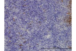 Immunoperoxidase of monoclonal antibody to CLIC3 on formalin-fixed paraffin-embedded human tonsil. (CLIC3 抗体  (AA 137-236))