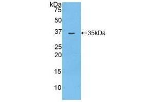 Detection of Recombinant MYO1D, Rat using Polyclonal Antibody to Myosin ID (MYO1D) (Myosin ID 抗体  (AA 512-788))