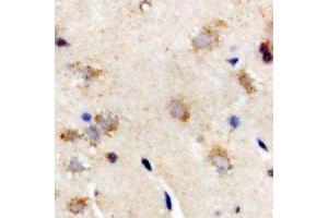 Immunohistochemical analysis of Interferon lambda-3 staining in rat brain formalin fixed paraffin embedded tissue section. (IL28B 抗体)