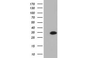 Western Blotting (WB) image for anti-Ketohexokinase (KHK) antibody (ABIN1499023) (Ketohexokinase 抗体)