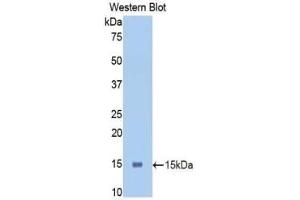 Detection of Recombinant PIGR, Mouse using Polyclonal Antibody to Polymeric Immunoglobulin Receptor (PIGR) (PIGR 抗体  (AA 463-563))