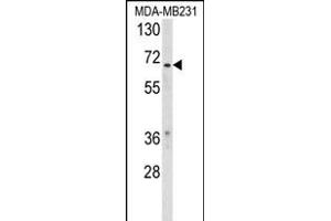 Western blot analysis of RXRB Antibody (Center) (ABIN653727 and ABIN2843034) in MDA-M cell line lysates (35 μg/lane). (Retinoid X Receptor beta 抗体  (AA 256-284))