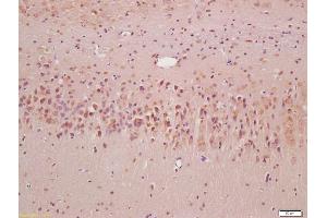 Formalin-fixed and paraffin embedded rat brain labeled with Anti-SQSTM1 Polyclonal Antibody, Unconjugated (ABIN682153) at 1:200, followed by conjugation to the secondary antibody and DAB staining (SQSTM1 抗体  (AA 51-150))