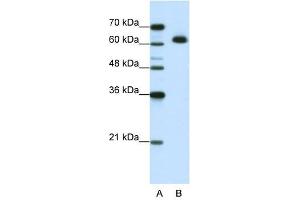 MGC42174 antibody used at 1. (DIS3L2 抗体  (N-Term))