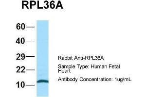 Host: Rabbit  Target Name: RPL36A  Sample Tissue: Human Fetal Heart  Antibody Dilution: 1. (RPL36AL 抗体  (C-Term))