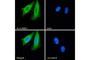 (ABIN238610) Immunofluorescence analysis of paraformaldehyde fixed U2OS cells, permeabilized with 0. (WISP1 抗体  (C-Term))