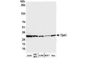 Western Blotting (WB) image for anti-TIP41-like protein (TIPRL) (C-Term) antibody (ABIN7453900) (TIPRL 抗体  (C-Term))