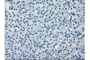 Immunohistochemistry (IHC) image for anti-Budding Uninhibited By Benzimidazoles 1 Homolog beta (Yeast) (BUB1B) antibody (ABIN1496995) (BUB1B 抗体)
