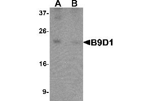 Western blot analysis of B9D1 in 293 cell lysate with B9D1 antibody at 1 µg/mL in (A) the absence and (B) the presence of blocking peptide. (B9D1 抗体  (C-Term))