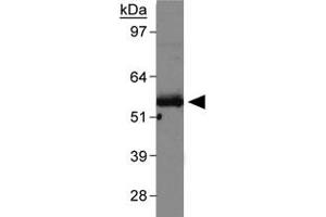 Western blot analysis of Slc2a9 in mouse kidney membrane with Slc2a9 polyclonal antibody . (SLC2A9 抗体  (AA 400-450))