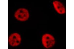 ABIN6274259 staining Hela cells by IF/ICC. (YAP1 抗体  (Internal Region))