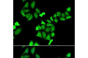 Immunofluorescence analysis of A549 cells using GALE Polyclonal Antibody (GALE 抗体)