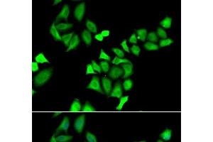 Immunofluorescence analysis of A549 cells using GALE Polyclonal Antibody (GALE 抗体)