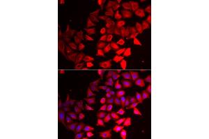 Immunofluorescence analysis of HeLa cells using CMPK1 antibody (ABIN5973940). (Cytidine Monophosphate (UMP-CMP) Kinase 1, Cytosolic (CMPK1) 抗体)