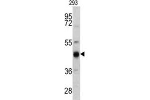 Western Blotting (WB) image for anti-Keratin 13 (KRT13) antibody (ABIN3002761) (Cytokeratin 13 抗体)