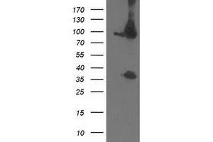 Western Blotting (WB) image for anti-Proteasome (Prosome, Macropain) 26S Subunit, Non-ATPase, 2 (PSMD2) antibody (ABIN1500480) (PSMD2 抗体)