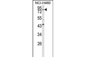 Western blot analysis of SPG20 Antibody (N-term) (ABIN652983 and ABIN2842623) in NCI- cell line lysates (35 μg/lane). (SPG20 抗体  (N-Term))