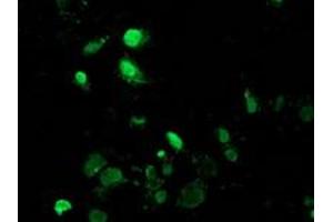 Anti-MAGEB18 mouse monoclonal antibody (ABIN2454279) immunofluorescent staining of COS7 cells transiently transfected by pCMV6-ENTRY MAGEB18 (RC206329). (MAGEB18 抗体)