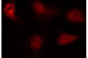 ABIN6274432 staining HeLa cells by IF/ICC. (ZNF397 抗体  (N-Term))