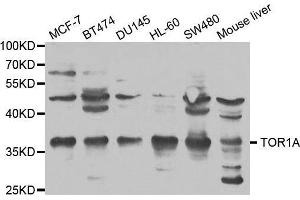 Western Blotting (WB) image for anti-Torsin Family 1, Member A (Torsin A) (TOR1A) (AA 63-332) antibody (ABIN3022837)