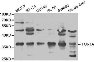 Western blot analysis of extracts of various cell lines, using TOR1A antibody. (TOR1A 抗体  (AA 63-332))