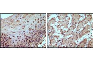 Immunohistochemical staining of paraffin-embedded human normal esophagus (A) and stomach (B) tissue, showing nucleus localization using Rb mouse mAb with DAB staining. (Retinoblastoma 1 抗体)