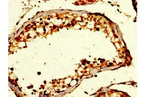 IHC image of ABIN7154533 diluted at 1:200 and staining in paraffin-embedded human testis tissue performed on a Leica BondTM system. (GDF1 抗体  (AA 369-478))