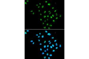 Immunofluorescence analysis of MCF7 cell using EIF6 antibody. (EIF6 抗体)