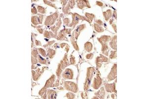Immunohistochemistry (Paraffin-embedded Sections) (IHC (p)) image for anti-Tubulin, alpha 1c (TUBA1C) (AA 414-441), (C-Term) antibody (ABIN655982)