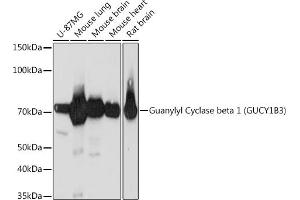 Western blot analysis of extracts of various cell lines, using Guanylyl Cyclase beta 1 (GUCY1B3) (GUCY1B3) Rabbit mAb (ABIN7267551) at 1:1000 dilution. (GUCY1B3 抗体)