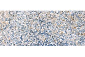 Immunohistochemistry of paraffin-embedded Human tonsil tissue using EMILIN1 Polyclonal Antibody at dilution of 1:70(x200) (Emilin1 抗体)