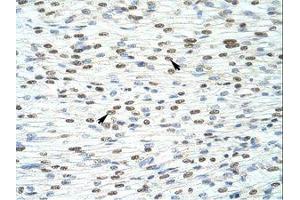 Image no. 1 for anti-HKR1, GLI-Kruppel Zinc Finger Family Member (HKR1) (C-Term) antibody (ABIN6736165) (HKR1 抗体  (C-Term))