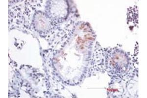 Immunohistochemistry image of B-Defensin 2 staining in paraffn section of human colon resection tissue. (beta 2 Defensin 抗体  (AA 4-41))