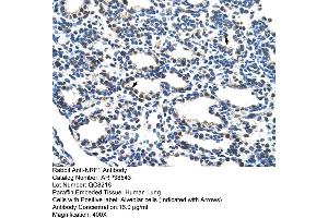 Human Lung (NRF1 抗体  (C-Term))