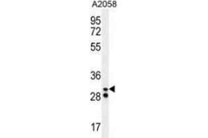 Western blot analysis in A2058 cell line lysates (35ug/lane) using Neutrophil elastase  Antibody (N-term). (ELANE 抗体  (N-Term))