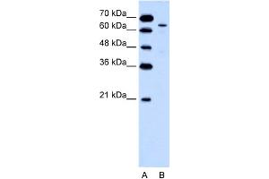 WB Suggested Anti-KRT2A Antibody Titration:  0.