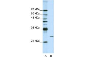 Western Blotting (WB) image for anti-Processing of Precursor 4, Ribonuclease P/MRP Subunit (POP4) antibody (ABIN2462223) (RPP29 抗体)