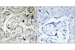 Immunohistochemistry analysis of paraffin-embedded human placenta tissue, using CYB5R3 Antibody. (CYB5R3 抗体  (AA 137-186))
