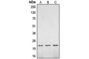 Western blot analysis of Caspase 2 p18 expression in mouse brain (A), rat brain (B), PC12 UV-treated (C) whole cell lysates. (Caspase 2 p18 抗体  (Center))