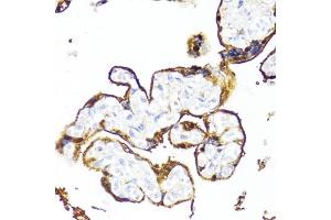Immunohistochemistry of paraffin-embedded human placenta using HSD17B1 antibody (ABIN6129829, ABIN6142002, ABIN6142003 and ABIN6215013) at dilution of 1:100 (40x lens). (HSD17B1 抗体  (AA 1-328))