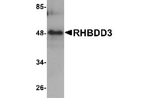 Western blot analysis of RHBDD3 in rat lung tissue lysate with RHBDD3 antibody at 1 µg/mL. (RHBDD3 抗体  (Middle Region))